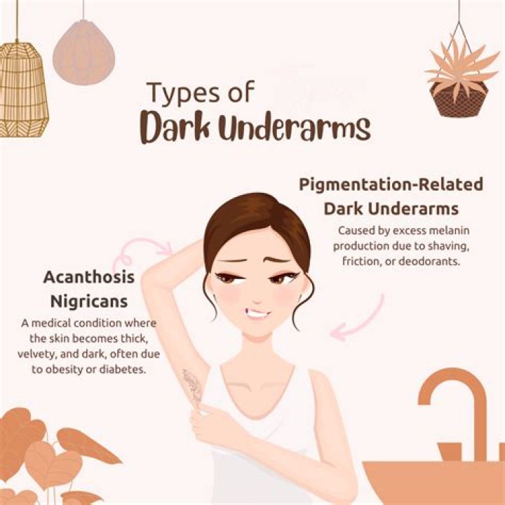 Unveiling the Mystery of Celebrities' Dark Underarms: Causes, Treatments, and Prevention